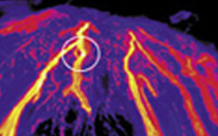 thermographie-infrarouge-Forest-fires